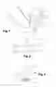 Fig. 02 - Method for retreading a tire casing comprising a step of inductive heating