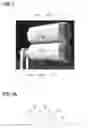 Fig. 02 - Device for embossing packaging material with a set of embossing rollers of the male-female die type