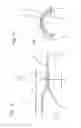 Fig. 02 - SUPPORT STRUCTURE FOR A MOTOR VEHICLE AND METHOD FOR PRODUCING A SUPPORT STRUCTURE FOR A MOTOR VEHICLE