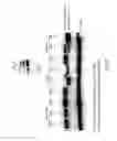 Fig. 05 - Virus like particle comprising modified envelope protein E3