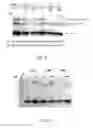 Fig. 06 - Virus like particle comprising modified envelope protein E3