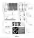 Fig. 04 - Micro-RNA regulation of bone loss