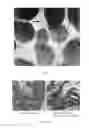 Fig. 02 - Transformation of duckweed and uses thereof