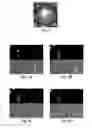 Fig. 04 - DETERMINATION OF IMMUNE CELLS AND OTHER CELLS