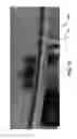 Fig. 15 - Multi-contact lipseals and associated electroplating methods