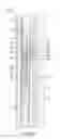 Fig. 07 - Drilling apparatus and methods for reducing circulation loss