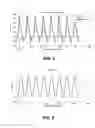 Fig. 09 - Noise, vibration and harshness reduction in a skip fire engine control system