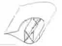 Fig. 01 - Wind turbine, a wind turbine blade, and a method of reinforcing a wind turbine blade