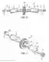 Fig. 06 - Ring gear of a mechanical exfoliation apparatus