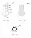Fig. 10 - Butterfly valve assembly