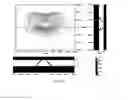Fig. 08 - Light distribution method for COB module LED street lamp lens capable of illuminating  3-5 lanes