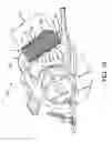 Fig. 11 - Configurable handgrip