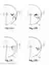 Fig. 16 - Relative aiming point display