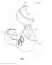 Fig. 02 - Disintegrating ammunition belt link