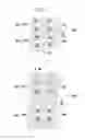 Fig. 06 - Liquid crystal display