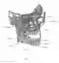 Fig. 02 - Method for automatic detection of anatomical landmarks in volumetric data