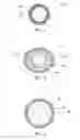 Fig. 02 - Expandable particulates and methods of use and preparation