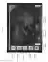 Fig. 02 - Annotation of endoscopic video using gesture and voice commands