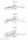 Fig. 06 - Mounting device for cymbal type percussion instrument
