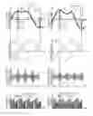 Fig. 01 - Electric motor control apparatus
