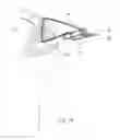 Fig. 09 - Knotless soft tissue attachment