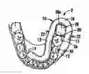 Fig. 01 - Dental isolator