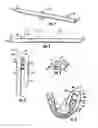 Fig. 02 - Dental isolator