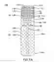 Fig. 02 - ESOPHAGEAL STENTS