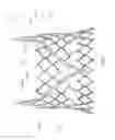Fig. 02 - Radially collapsible frame for a prosthetic valve and method for manufacturing such a frame