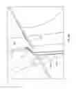 Fig. 07 - Prosthetic heart valve square leaflet-leaflet stitch