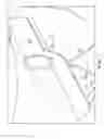 Fig. 08 - Prosthetic heart valve square leaflet-leaflet stitch