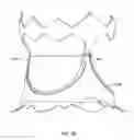 Fig. 07 - Collapsible prosthetic heart valves