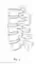 Fig. 02 - Facet joint implant