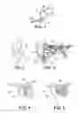 Fig. 02 - Ear insert for relief of TMJ discomfort and method for use thereof