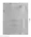 Fig. 02 - Biomaterial, injectable implant comprising it, its method of preparation and its uses
