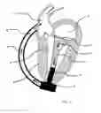 Fig. 02 - Cardiac support system and a cardiac support method