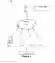 Fig. 02 - System and method for determining an injectable amount of bile required after gallbladder removal surgery