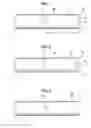 Fig. 02 - Neural injection system and related methods