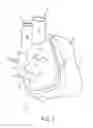 Fig. 02 - Face Mask for Administration of Gaseous Anesthesia