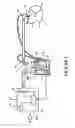 Fig. 02 - Breathing assistance apparatus