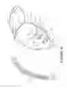 Fig. 09 - Breathing assistance apparatus