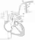 Fig. 01 - Devices and methods for minimally invasive coronary bypass and other treatments
