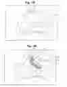 Fig. 02 - Devices and Methods For Minimally Invasive Access to Sinuses And Treatment of Sinusitis