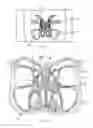 Fig. 02 - Sinusitis treatment system and method of use