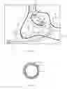 Fig. 07 - Sinusitis treatment system and method of use