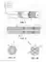 Fig. 02 - METHOD AND APPARATUS FOR TREATING BENIGN PROSTATIC HYPERPLASIA WITH LIGHT-ACTIVATED DRUG THERAPY