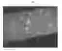 Fig. 01 - FILTER MEDIA FOR FILTERING MATTER FROM A FLUID