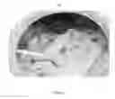 Fig. 08 - FILTER MEDIA FOR FILTERING MATTER FROM A FLUID