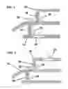 Fig. 02 - FOREIGN OBJECT DEBRIS BARRIER FOR RUNWAYS