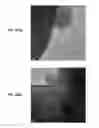 Fig. 22 - Piezoelectric-effect-induced heterogeneous electrochemical reactions